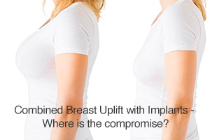 Combined Breast Uplift with Implants - Where is the compromise?