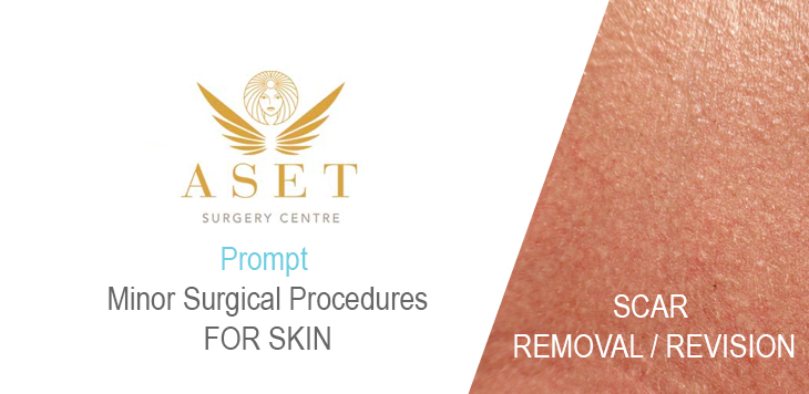ELITE SURGEON Mr Hassan Shaaban SPECIALISING scar surgical removal and revision 