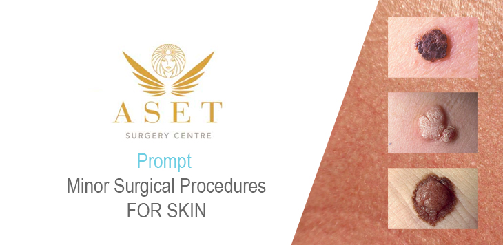 Prompt cyst surgical treatments promt and no waiting