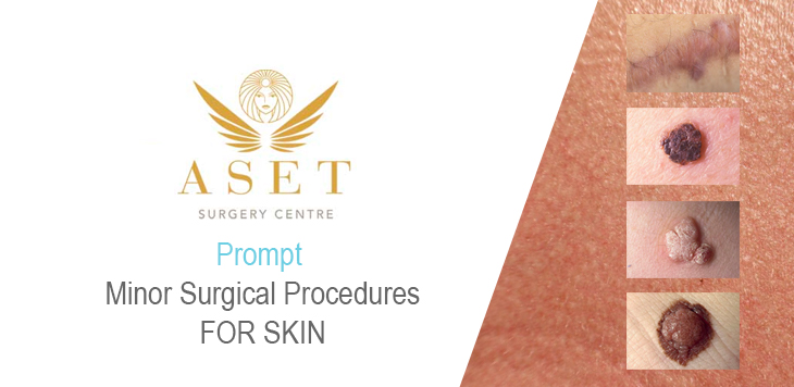 skin surgery treatments for moles, lesions, lumps, cysts and scar removal specialist in skin procedures performed by hugely experienced and respected  cosmetic plastic surgeons at Aset Hospital - Liverpool