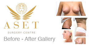 view photographic gallery of before and after face surgery